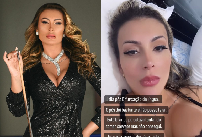 Imagens Fortes Andressa Urach Choca Ao Realizar Procedimento Que